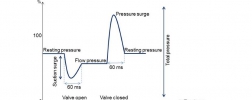 Chart: Pressure spike